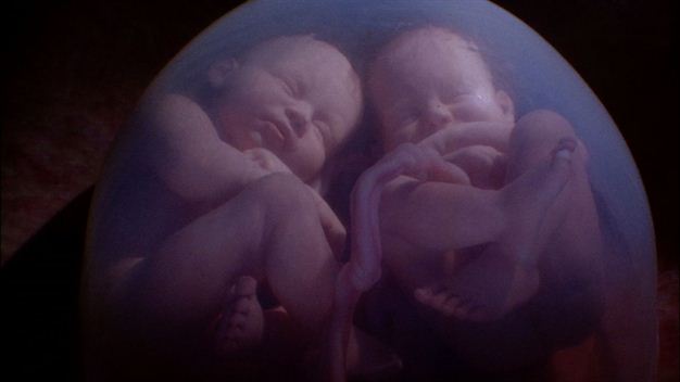 twins in womb